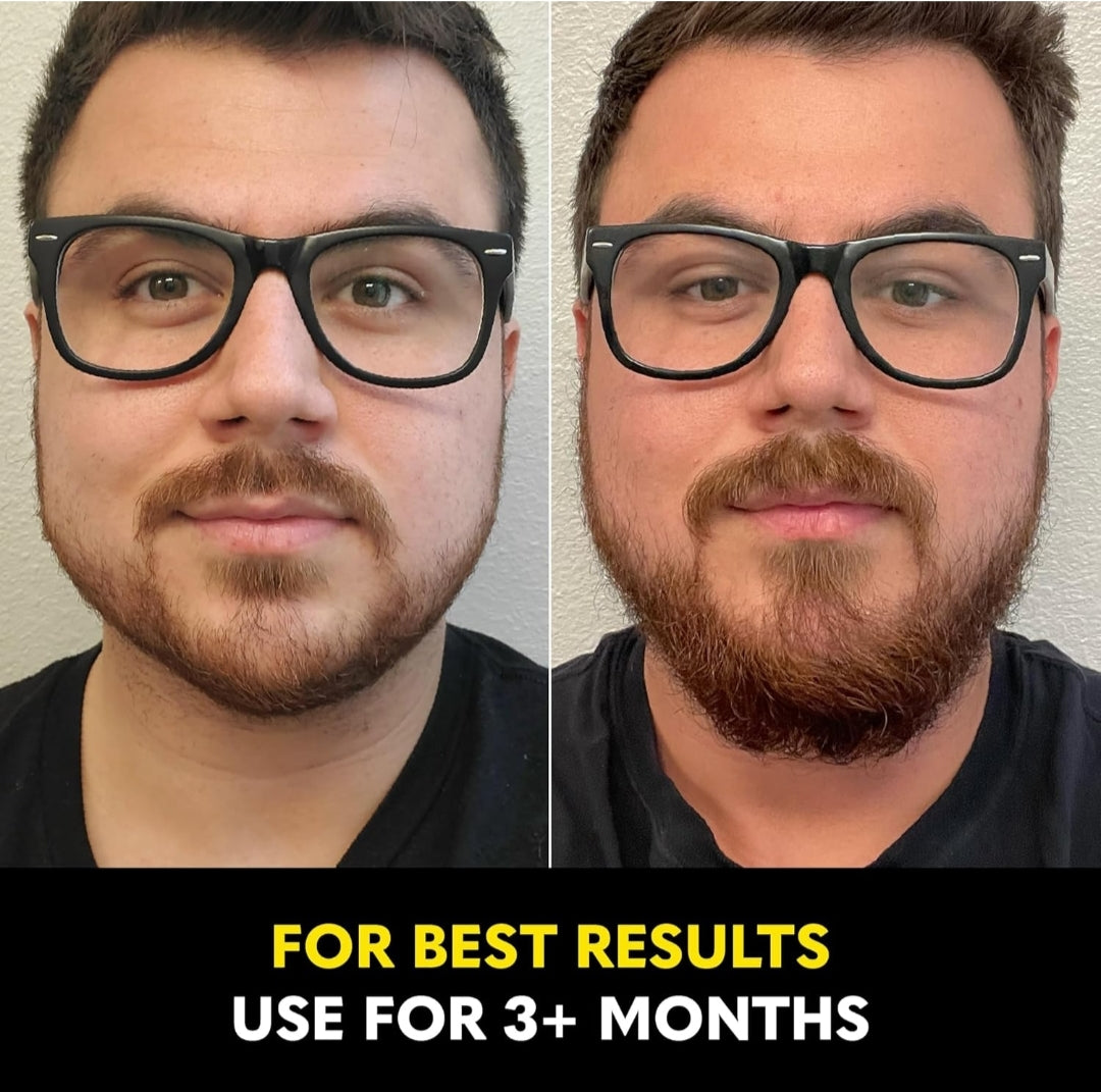The Beard Club - Biotin Beard Growth Vitamins